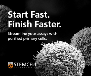 ON939HSPC-Primary Cells Start Fast_300 x 250