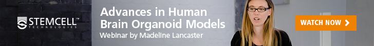 Webinar: Advances in Human Brain Organoid Models