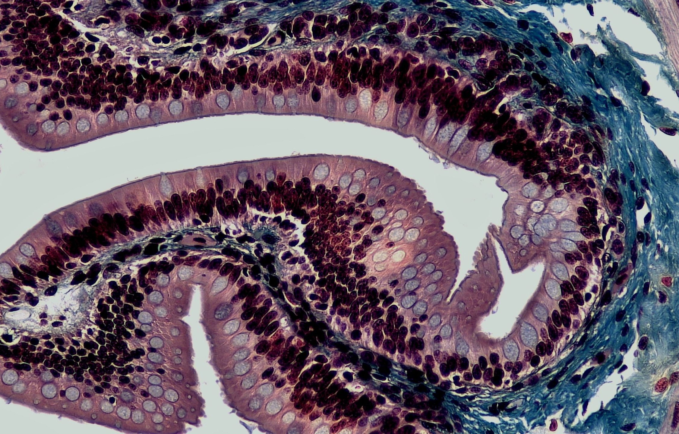 Intestinal-Cross-Section-scaled-e1608163000310