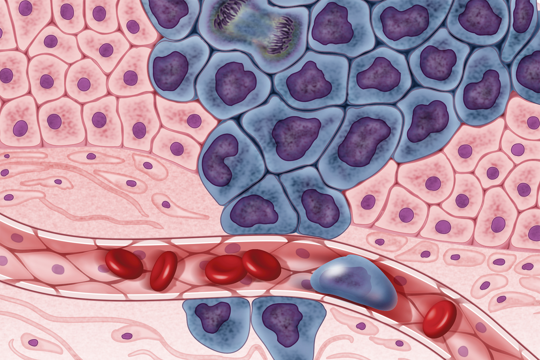 generic-cancer-cells