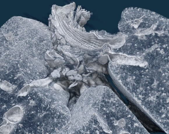 microtomography