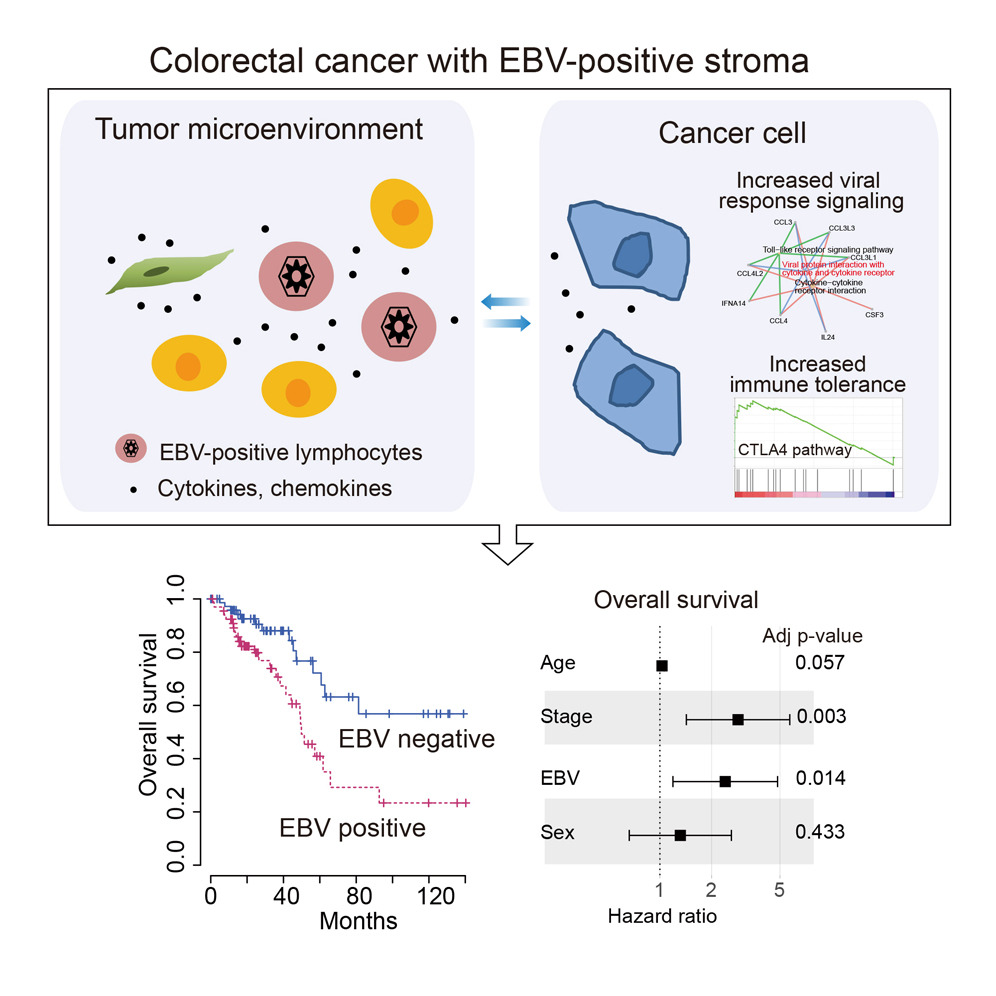 Reshaping Tumor Immune Microenvironment by EpsteinBarr Virus